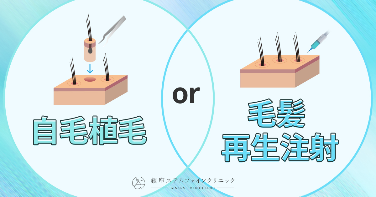 【中古】 医療植毛の最新テクニック 自毛植毛と毛髪再生注射の違いを解説。あなたに合うのはどっち