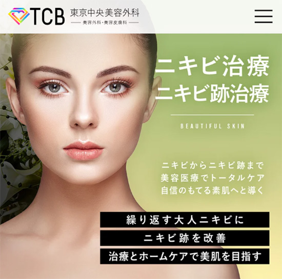 TCBニキビ