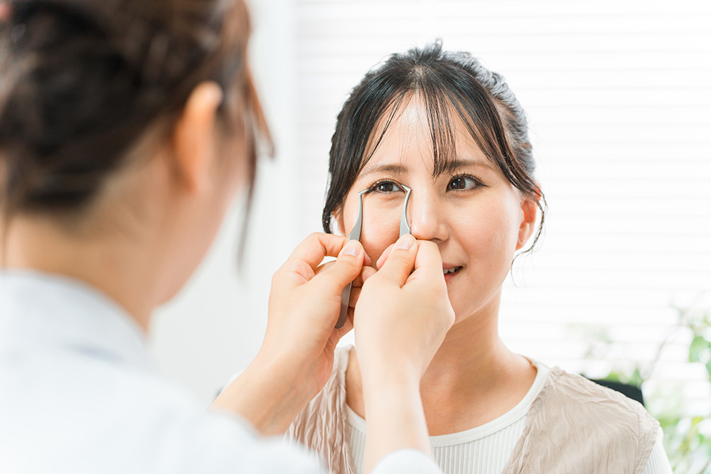 二重整形の相談する女性患者