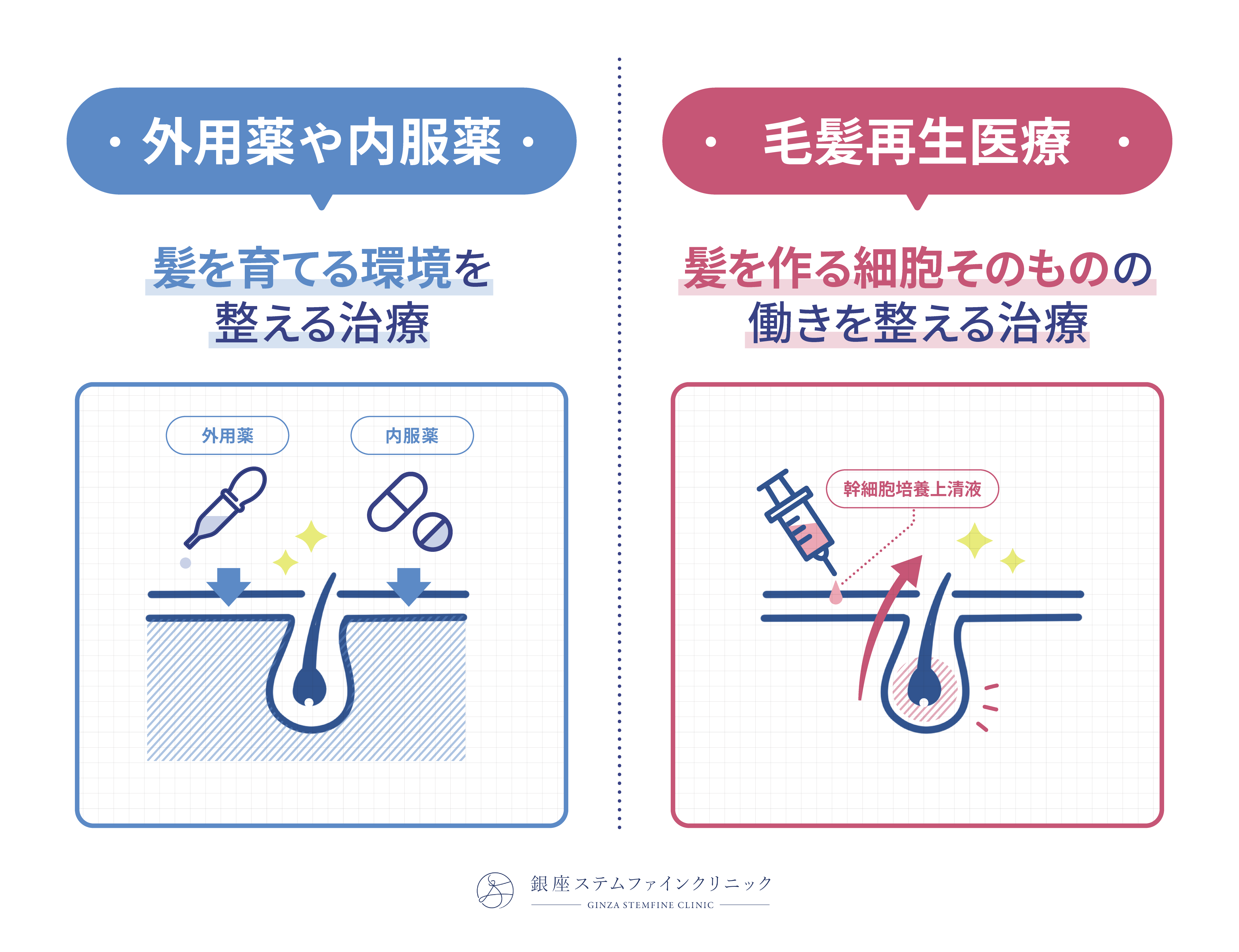 内服薬と毛髪再生治療の考え方の違い